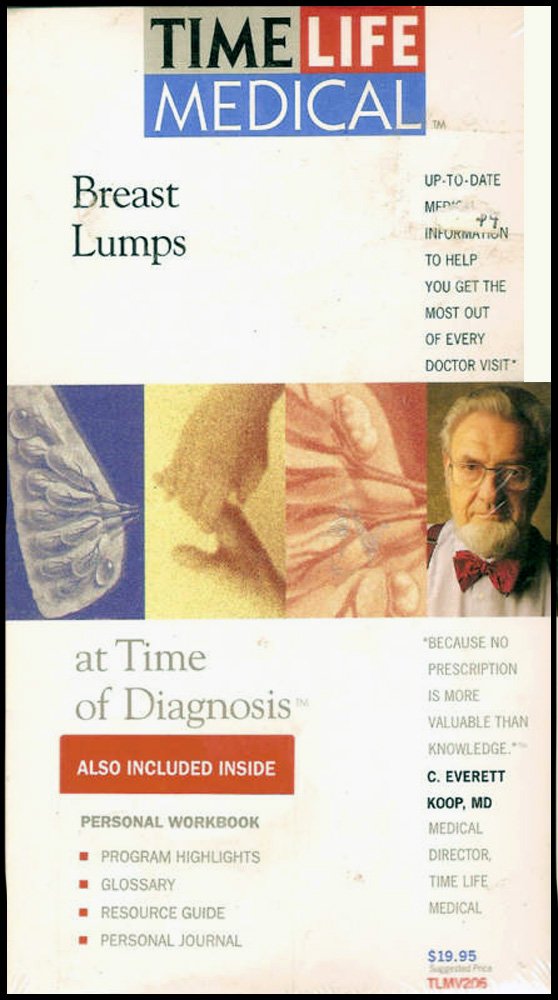 Image 0 of Breast Lumps On VHS